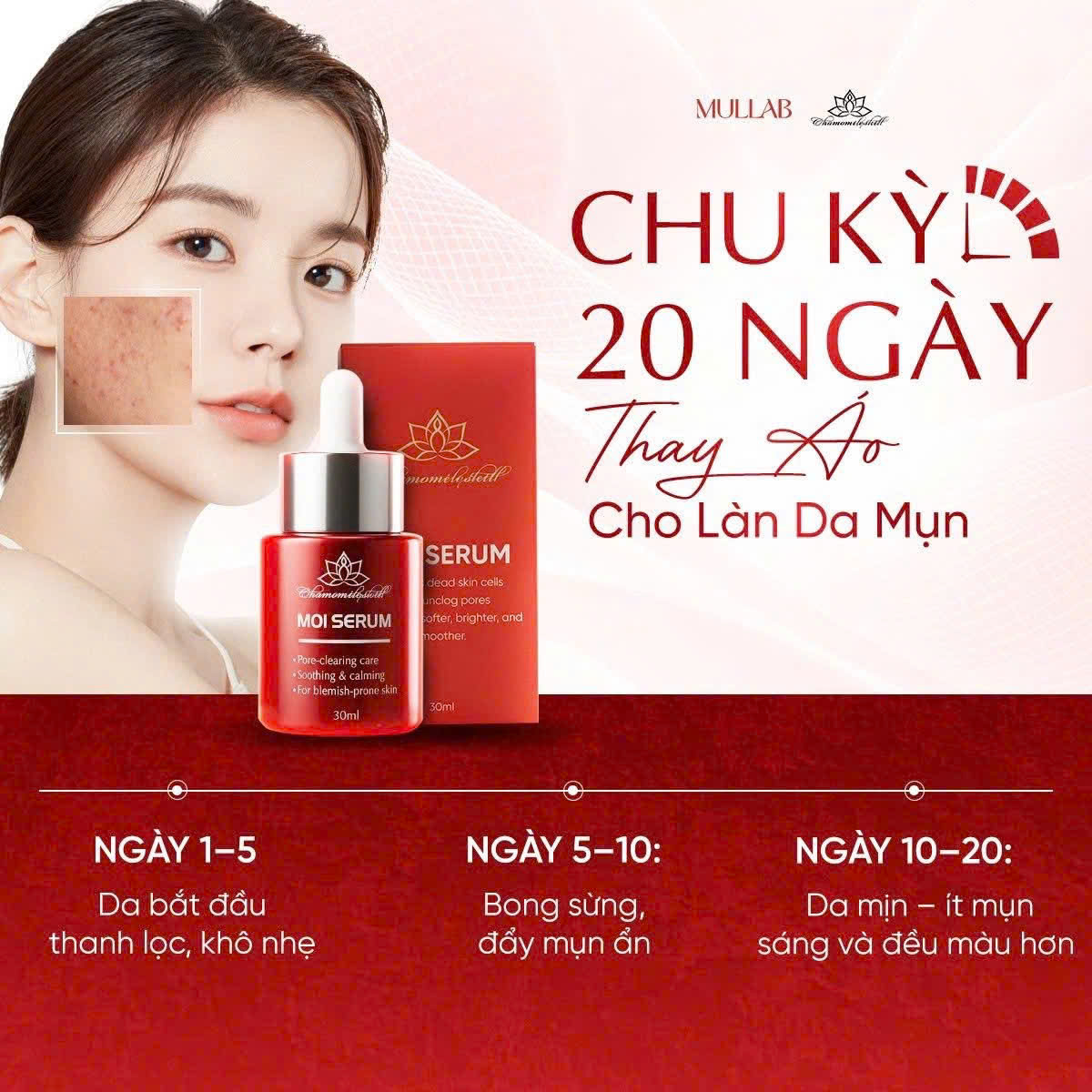 Đông y trị mụn Chamomile